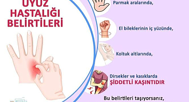 Uyuz Hastalığı'ndan Korunma Yolları ve Tedavi