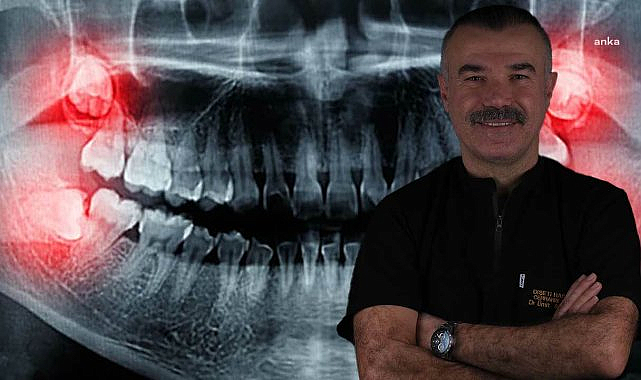 Yirmilik dişler ihmale gelmiyor! Uzmanı uyardı: "Gülüşünüz bozulabilir"