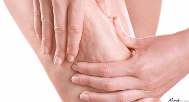 Prof. Dr. Ahmet Karacalar’dan Ezber Bozan Selülit Çıkışı: “Selülit Sadece Bir Estetik Kusur Değil, Metabolik Bir Aynadır!”