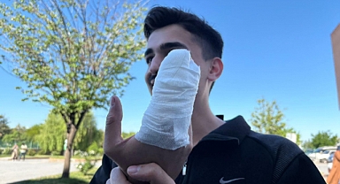 Malatya'da acemi kasaplar hastanelik oldu