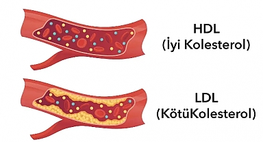 Kolesterol ve trigliserit nasıl düşürülür? Son araştırmalar ne yenmesi, neyin azaltılması gerektiğini gösteriyor